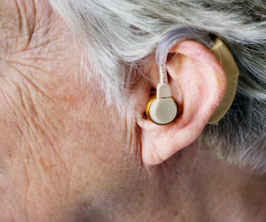 רעשים באוזניים וירידה בשמיעה- האם איכות השמיעה קשורה לכך